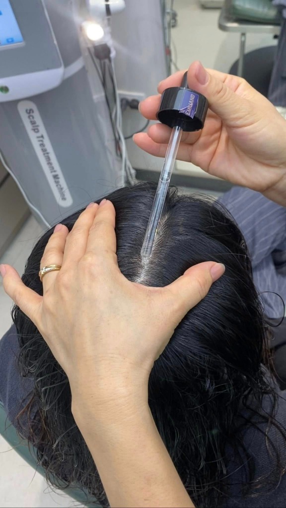 Soi da đầu bít tắc tại Kim Loan Hair Salon