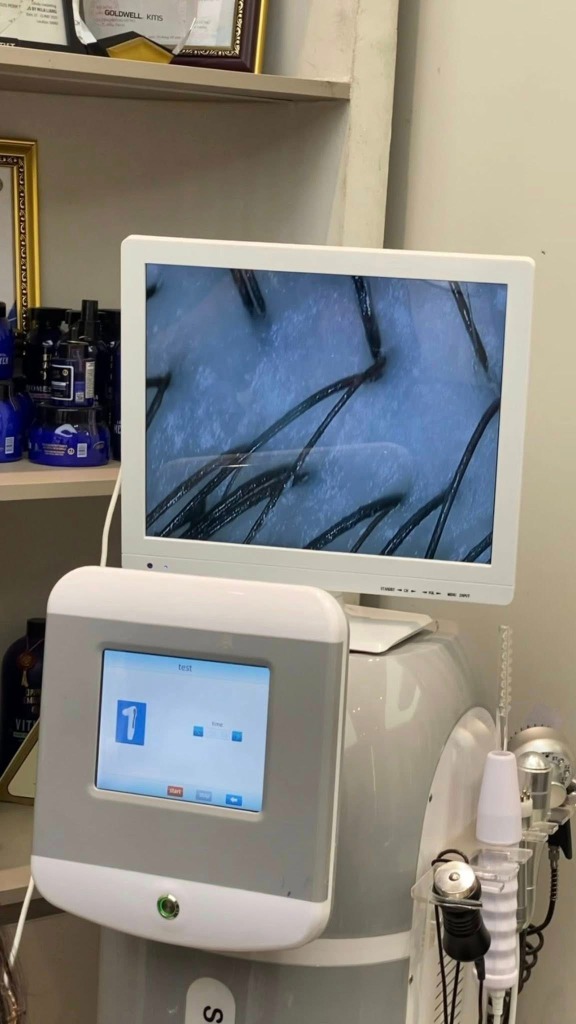 Kết quả sau khi soi da đầu chuyên sâu