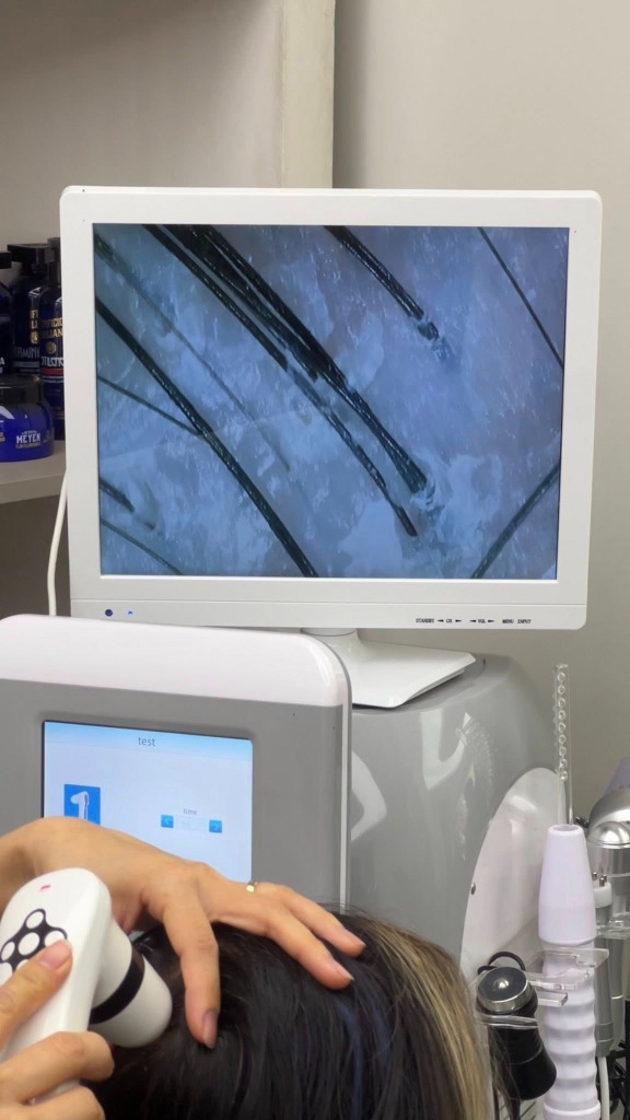 Quy trình chăm sóc và detox da đầu chuyên sâu