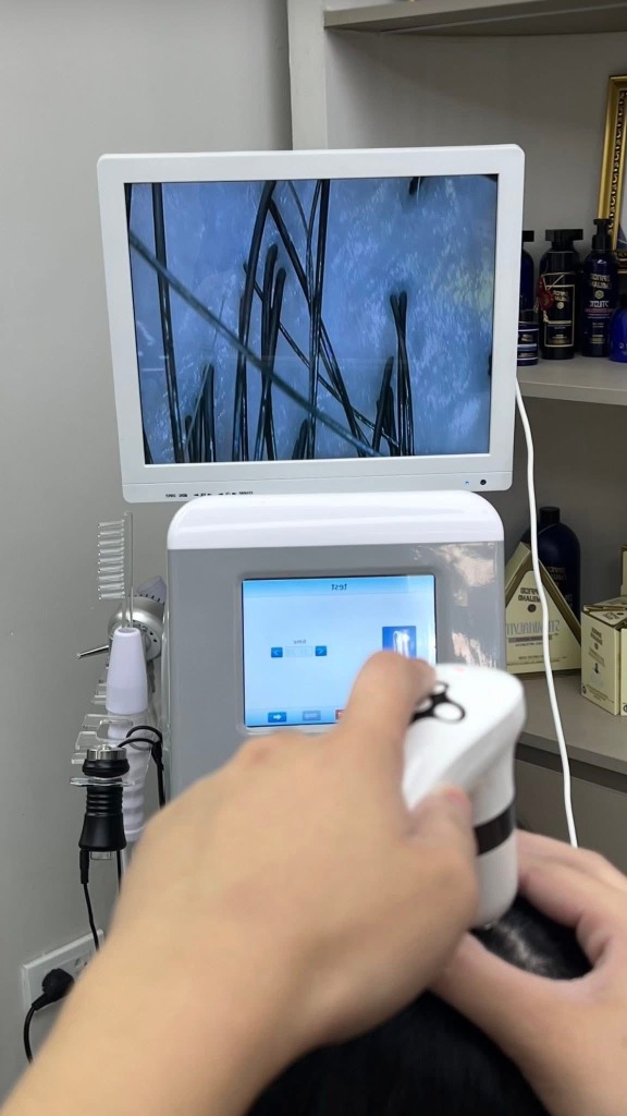 Kiểm tra da đầu với thiết bị chuyên dụng