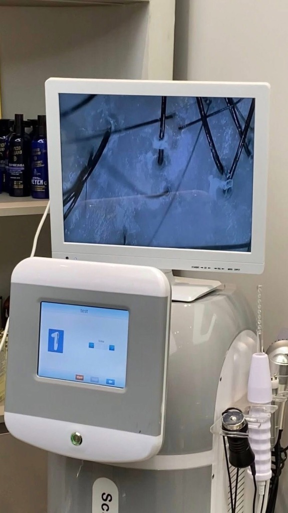 Soi và kiểm tra da đầu trước khi làm dịch vụ